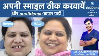 Best Smile Designing in Jaipur