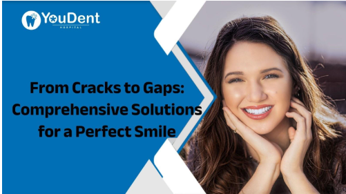 Solutions for a Perfect Smile